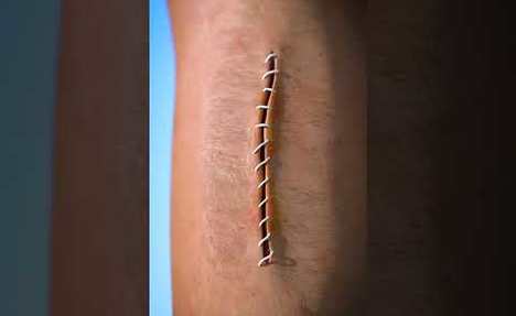 How Stitches Work
